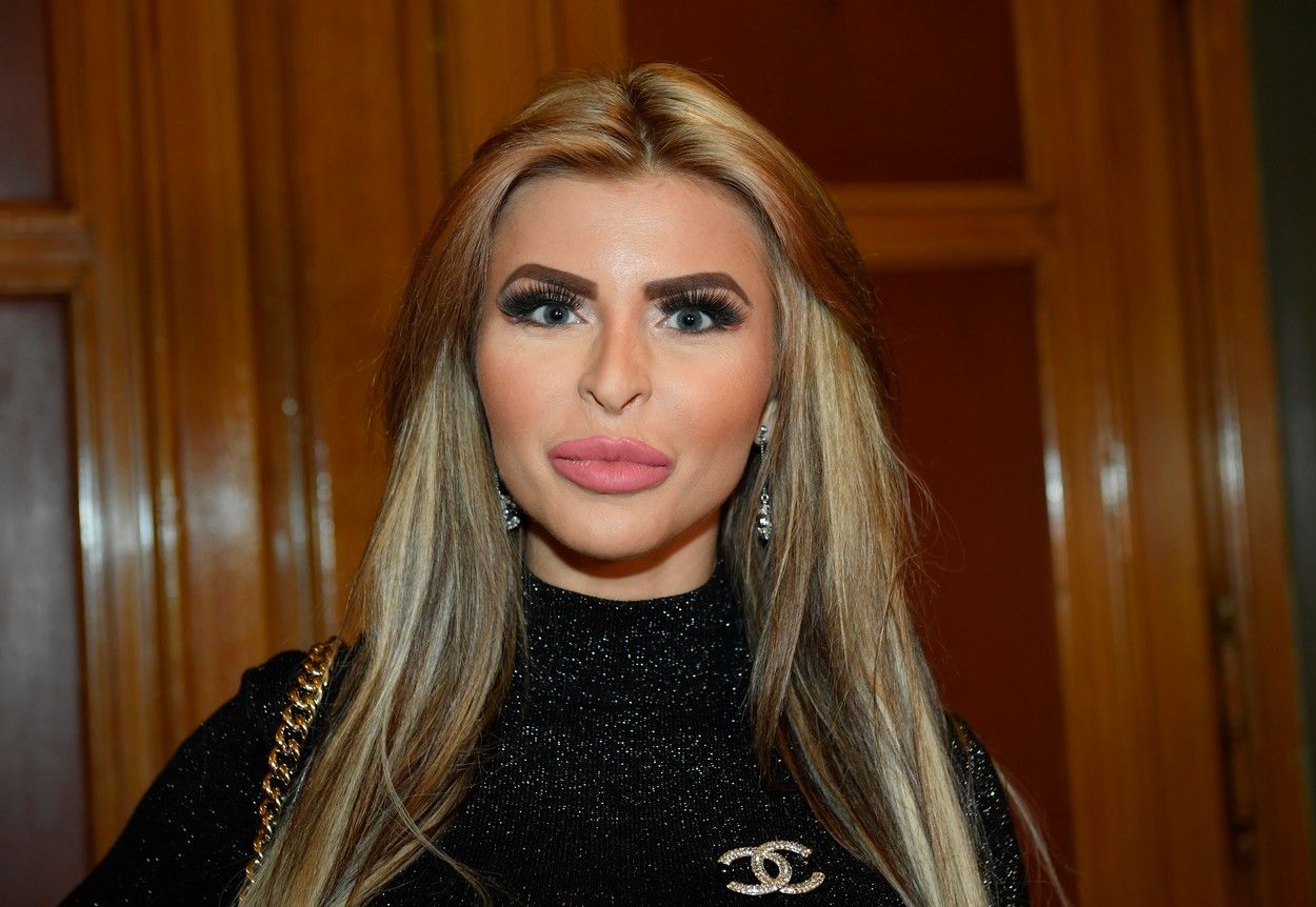 Expert Butt Plastic Surgery in Turkey: Lela Vémola’s Journey to Her Dream Look