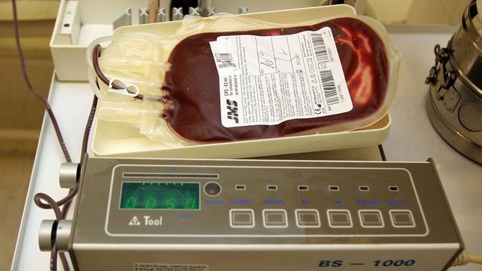 V Thomayerově nemocnici provádějí pouze odběry tzv. plné krve. Naplnění pytlíku 450 mililitry krve trvá přibližně pět minut.