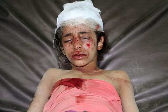 Zraněná dívka po leteckém úderu arabské koalice v jemenském městě Saada. 