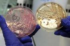 Odolné bakterie zabijí v roce 2050 víc lidí než rakovina