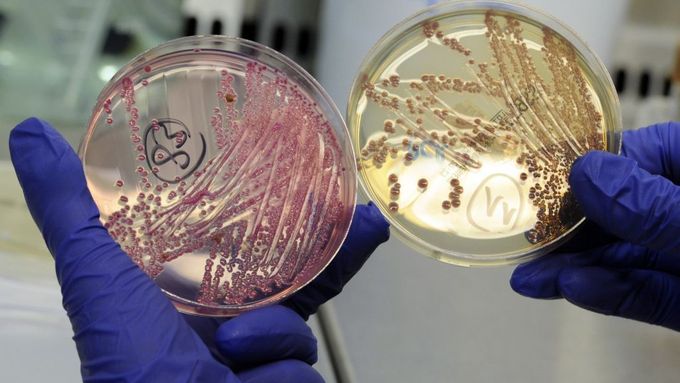 Bakterie objevená ve Francii náleží jinému kmeni E. coli než ta, jež způsobila nákazu v Německu.