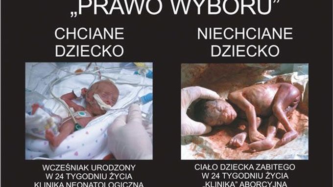 Snímek z výstavy Vyber život: "Právo výběru: "Chtěné dítě - předčasně narozené dítě ve 24 týdnu těhotenství, neonatologická klinika. Nechtěné dítě - tělo dítěte zabitého ve 24 týdnu života, potratová klinika"