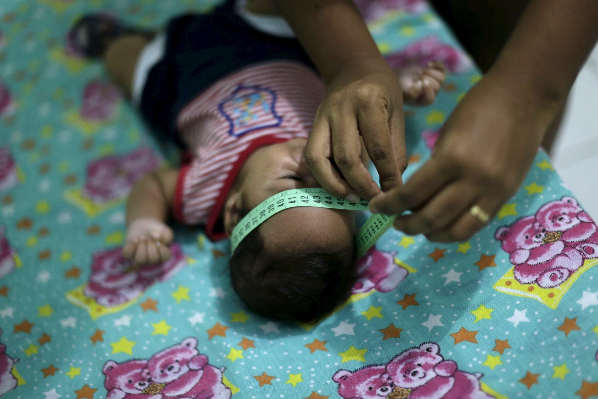 Guilherme Soares Amorim. Dvouměsíční dítě s mikrocefalií.