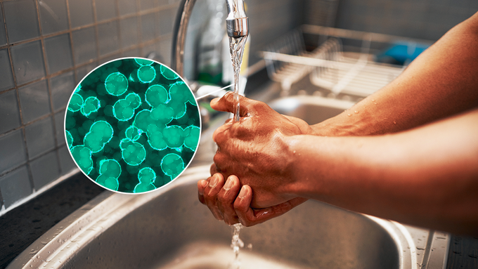 Odborníci proto doporučují, aby si lidé ohřívali svou užitkovou vodu nejméně na 50 stupňů Celsia - takové podmínky totiž legionella nepřežije.