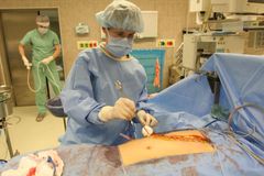 Čeští lékaři budou poprvé transplantovat tenké střevo