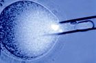 Z části lidské a z části prasečí embryo. Američtí vědci "vypěstovali" chiméru v těle prasnice