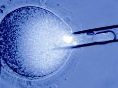 Obrázek vydaný společnosti Stemagen: odsávání jádra z lidského vajíčka. Na jeho místo pak přijde jádro z jiné buňky; to je podstata klonování.