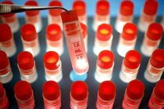 Proti etice? Lékařská komora prověří léčbu kmenovými buňkami