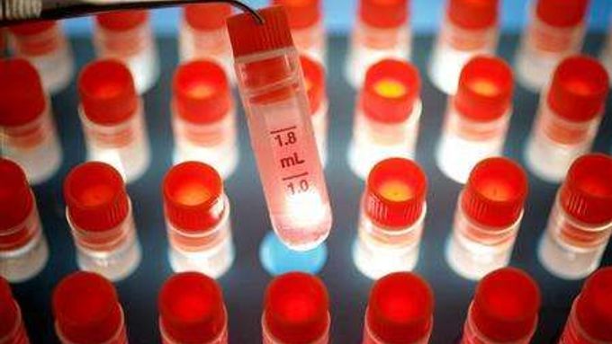 Zkumavky obsahující kmenové buňky jsou vystavovány v Londýně. Výzkumníci z Hardwardské University, zveřejnili v úterý, že začínají s programem klonování lidských embryí jako zdroje hodnocení kmenových buněk.