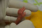 Rodičky pomohly v Podolí zachránit miminko vážící 322 gramů. To už je opravdu extrém, říká lékařka