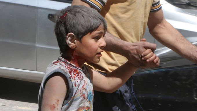 Chlapec raněný při útoku v povstalci kontrolované části Aleppa (duben 2016).