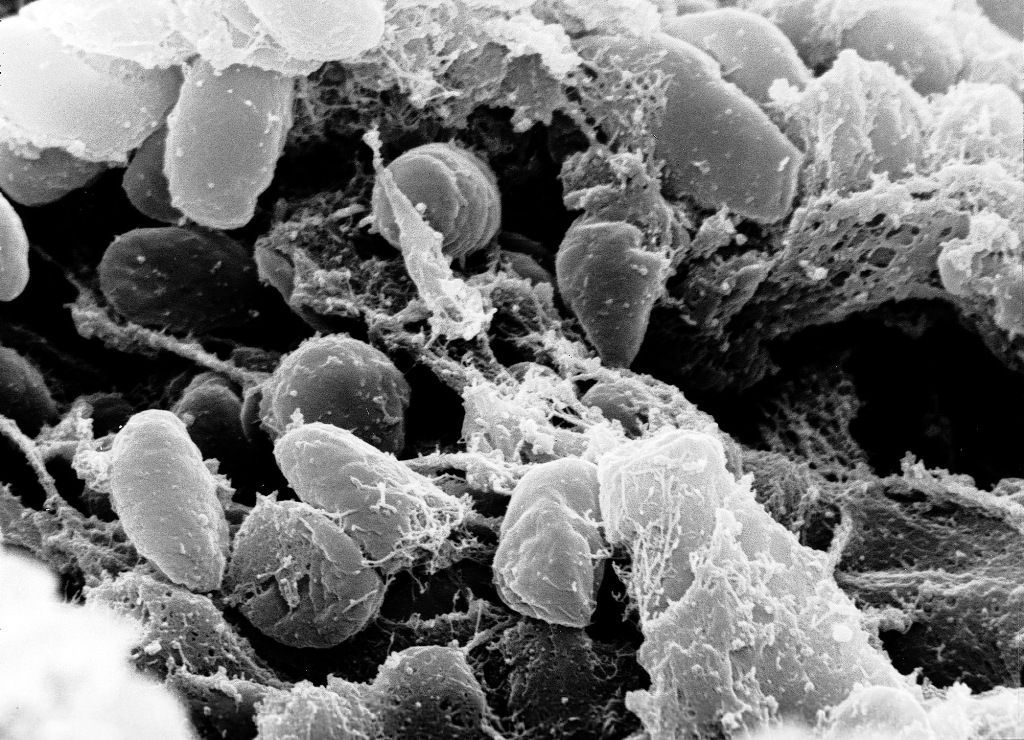 Yersinia Pestis, bakterie způsobující mor