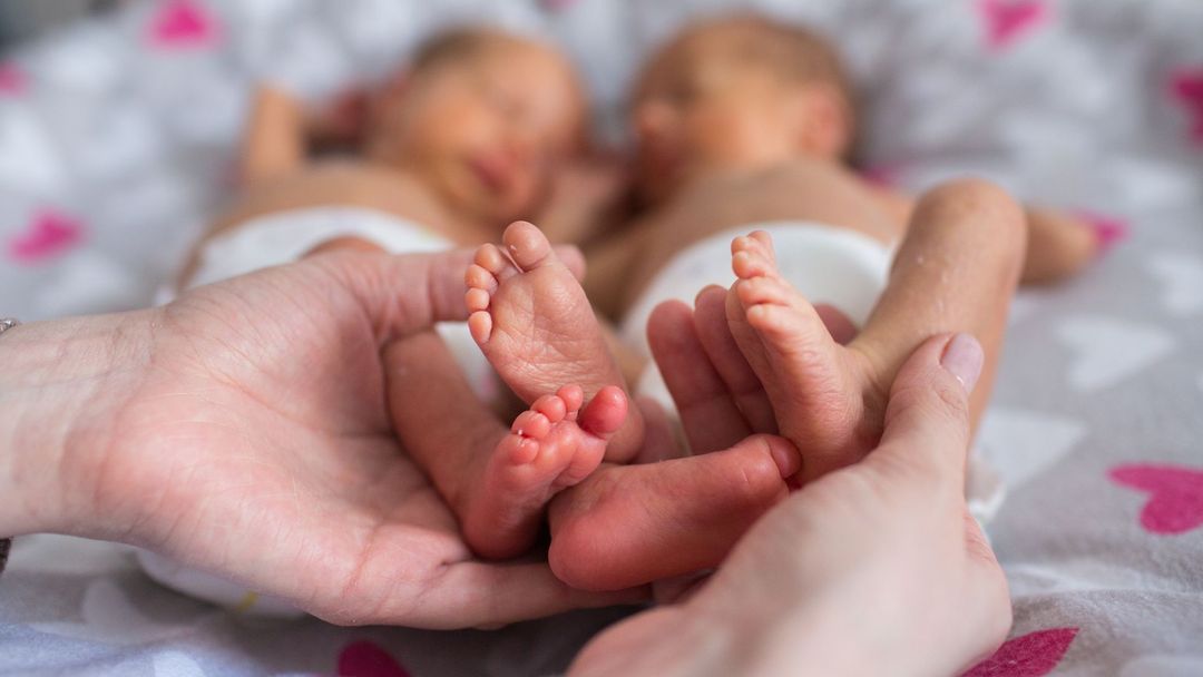 Kdyby se dvojčata narodila jen o hodinu dříve, lékařský tým by jim nemohl pomoci. 