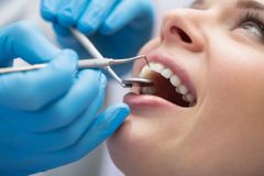 Zubní kazy se přenášejí i líbáním, tvrdí lékařka. Její vzkaz na TikToku je hitem