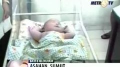 Indonéská žena přivedla na svět 9kilové dítě