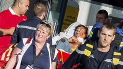 French emergency services transport a victim after a shooting on the Amsterdam to Paris Thalys high-speed train in Arras