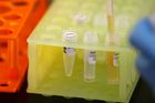 Kalifornští výzkumníci se neúnavně snaží vyvinout vakcínu proti koronaviru.