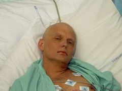 Alexandr Litviněnko v nemocnici.