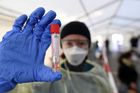 Jaký je stav "závodu o vakcínu" proti koronaviru? Vědci jsou opatrně optimističtí
