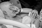 Dojemné fotky kojící matky podstupující chemoterapii obletěly svět. Syn jí pomohl zvládnout rakovinu