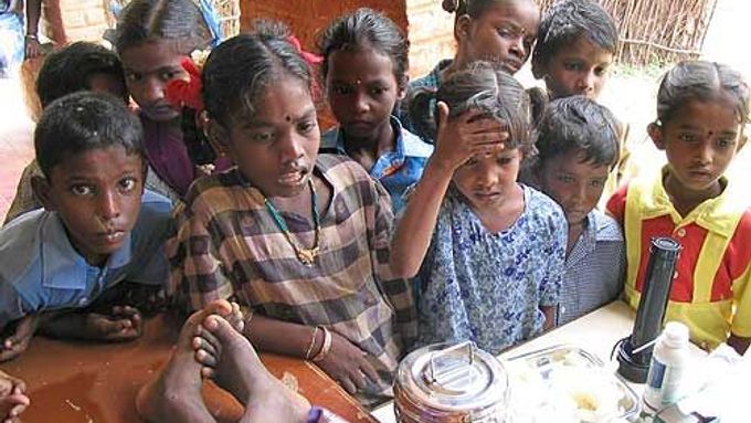 Nejvíce dětí dnes trpí podvýživou v Indii.
