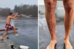 Krvavá legrace. Norská biatlonová hvězda doplatila na sváteční otužování
