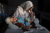 První cena v kategorii Každodenní život. Najiba drží v nemocnici dvouletého synovce Shabira, který byl zraněn při výbuchu bomby v afghánském Kábulu. Autor: Paula Bronstein, Time Lightbox.