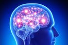 Složitým testům odzvoní, inteligenci změří sken mozku