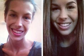 Antonie (18) porazila mentální anorexii přes Instagram
