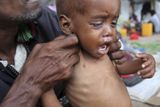 V celém Africkém rohu je kvůli vysokým cenám potravin a suchu v ohrožení života nejméně půl milionu dětí, tvrdí Dětský fond OSN (UNICEF).