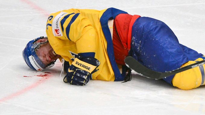 Nejtvrdší zápas na MS. V zápase Rusko - Švédsko tekla krev