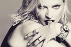 Glosa: I s hitmakery v zádech je Madonna v křeči