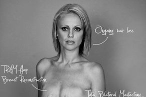 FOTO Australanka odhalila své tělo po rakovině