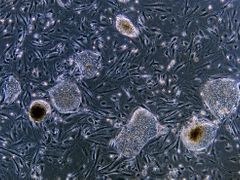 Mikroskopický snímek kmenových buněk z lidského embrya, jejichž využití slibuje převrat v medicíně. Kolonie těchto buněk tvoří okrouhlé útvary. Ploché protáhlé buňky mezi buněčnými koloniemi jsou fibroblasty (pojiva), které fungují jako výživná vrstva, v níž kmenové buňky rostou.