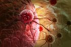 Čeští vědci otevřeli novou cestu k léčbě rakoviny