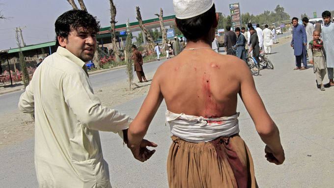 Zraněný Afghánec po útoku na vojenský konvoj NATO.