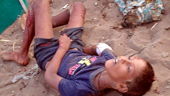 Zraněný tamilský chlapec na snímku, který agentuře Reuters poskytla skupina WarWithoutWitness.com
