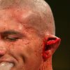Hrozivá zranění v boxerské historii