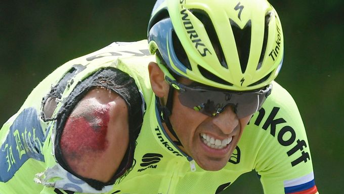 Alberto Contador po pádu v první etapě Tour cestou do cíle hodně trpěl.