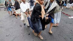 Šíitští rebelové odnášejí zraněného muže z místa sebevražedného útoku v Saná