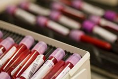 Prokážeme už i krevní doping, hlásí do světa vědci