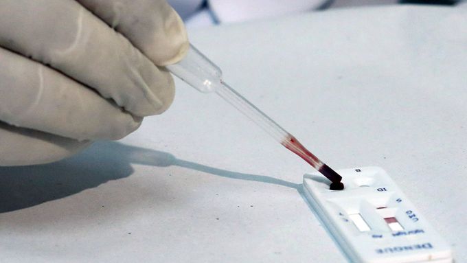 Testy na virus zika se budou provádět v laboratořích ve třech českých městech. (Ilustrační foto)