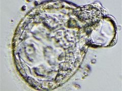 Klonované embryo na snímku společnosti Stemagen.