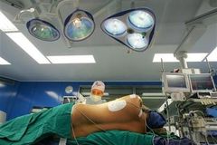 Lékaři operují Vietnamce s 90kilogramovým nádorem