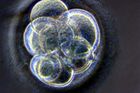 Přišel čas povolit genetické modifikace embryí, vyzývá sdružení expertů, etiků a politiků