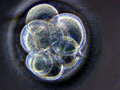 Lidské embryo pod mikroskopem.