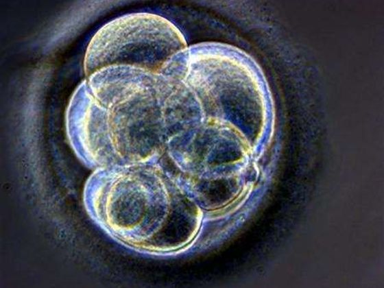 Potrat půl napůl embryo