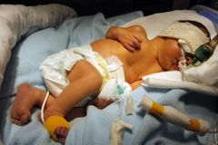 Dítě zemřelo při porodu doma. Hazard, zlobí se lékaři