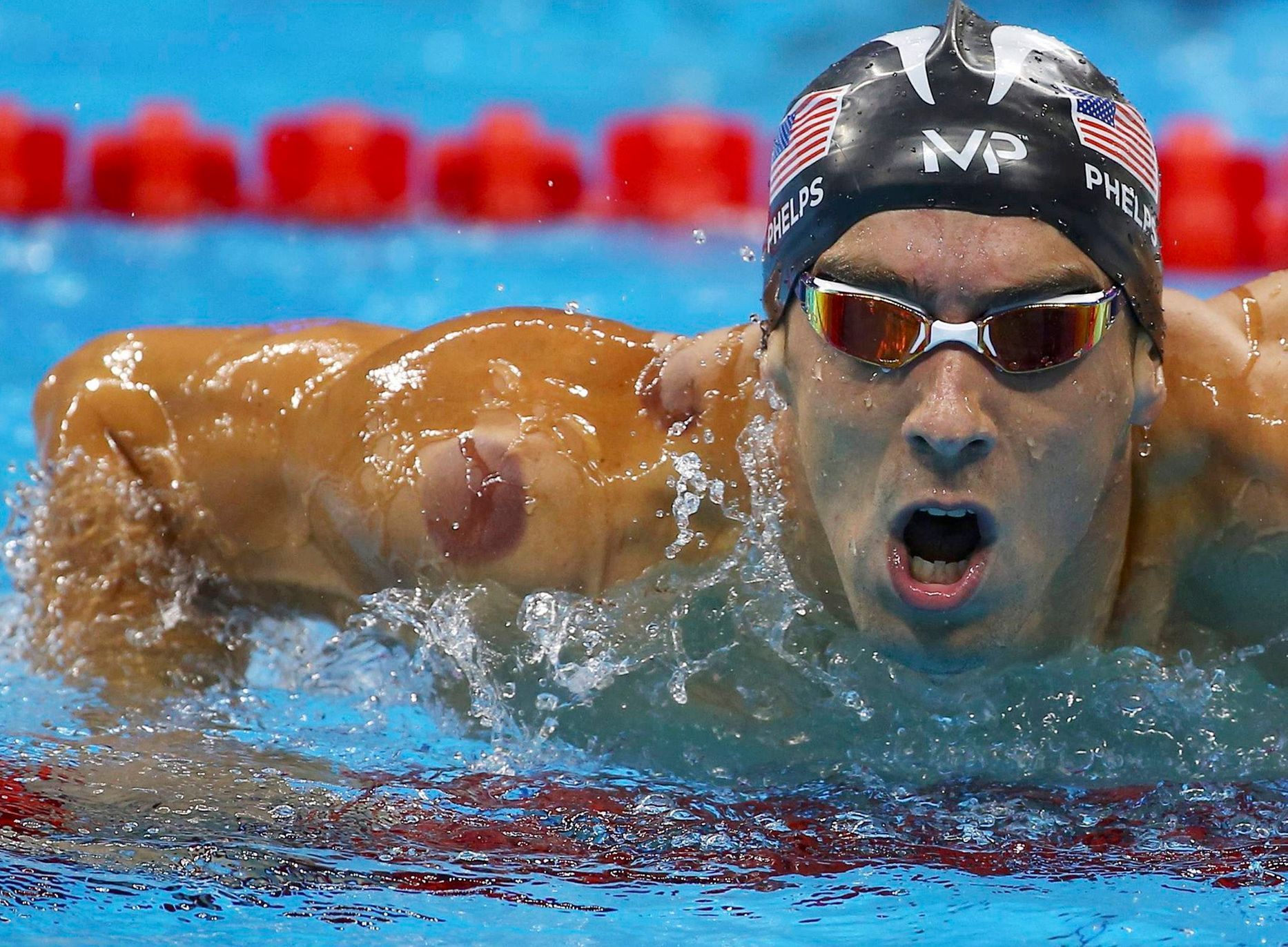 Michael Phelps of the US is seen with a red cupping mark on his shoulder as he competes in the Men's 4 x 100m Freestyle Relay Final at the 2016 Rio Olympics in Rio de Janeiro