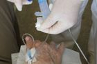 Čtyři lékaři na 13 000 pacientů. Tak léčí rakovinu v Gaze